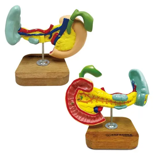 Diseased Pancreas, Spleen and Gallbladder