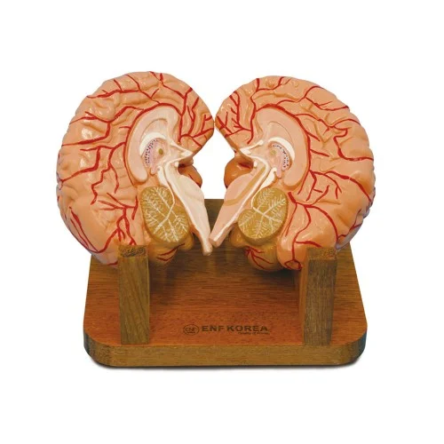 Brain with Arteries 2 Parts