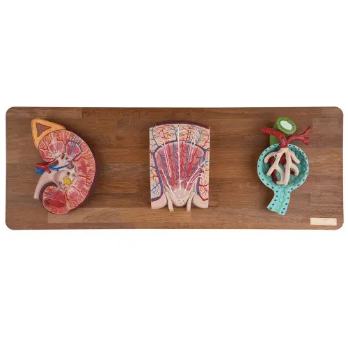 Kidney Section with Renal Nephron and Renal Corpuscle