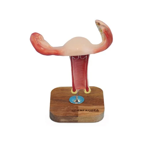 Normal Uterus Model