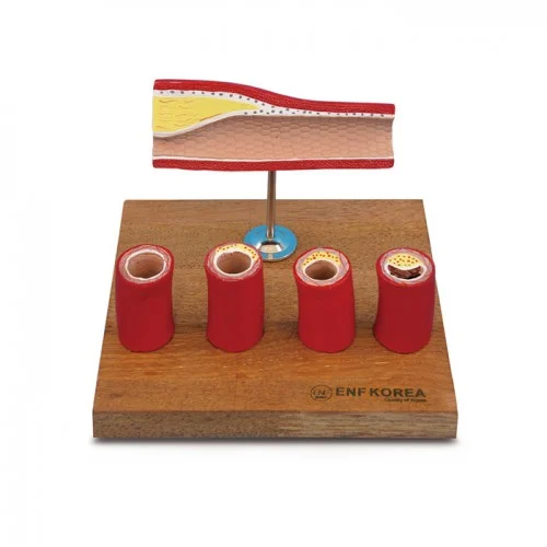 [EC17A] Artery Model with 4 Cross Sections