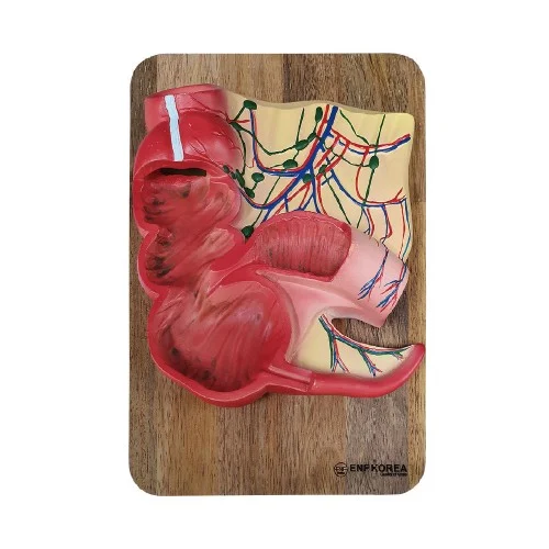 [ED14] Appendix and Caecum Model