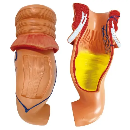 [ED15A] Enlarged Rectum Model