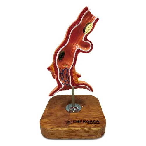 [ED16] Esophagus Disease Model
