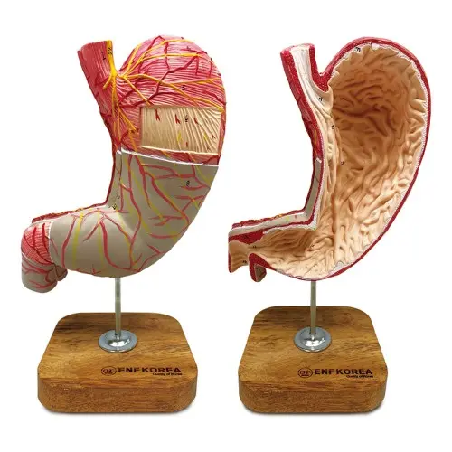 [ED21] Enlarged Stomach Model 2 Parts