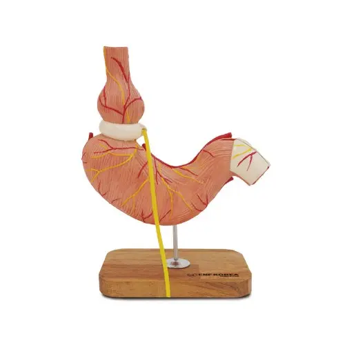 [ED21E] Stomach Model with Gastric Band