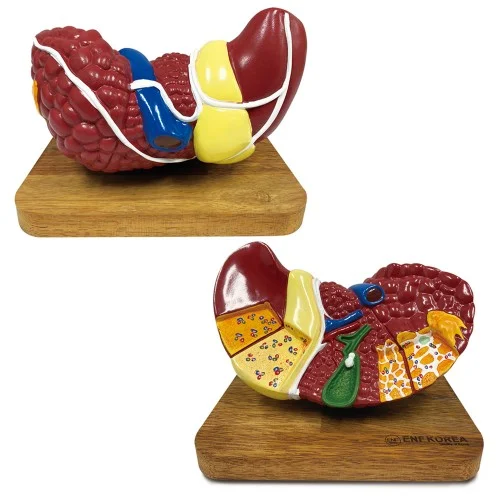 [ED35] Diseased Liver Model