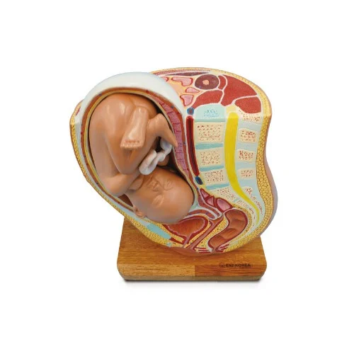 [EHB51] Pregancy Pelvis with Mature Fetus
