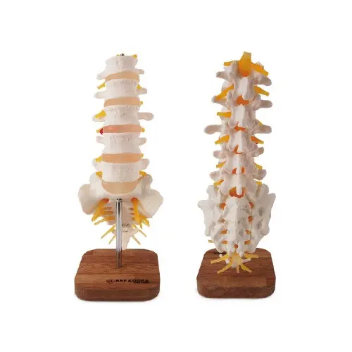 [EL31] Lumbosacral Vertebrae and Nerves Model