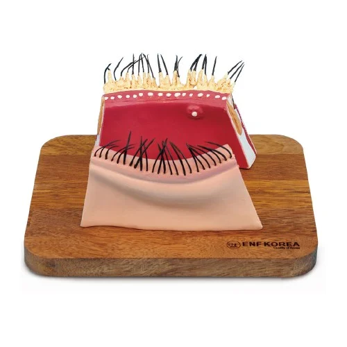 [ES38] Blepharitis Model
