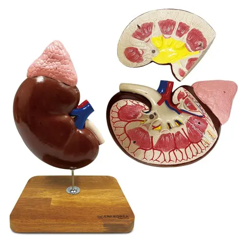 [EU22] Enlarged Kidney with Adrenal Gland 2 parts