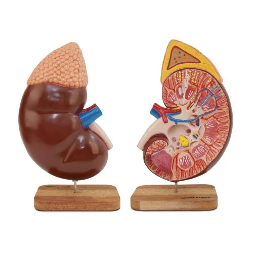 [EU22A] 3.5 Times Enlarged Kidney with Adrenal Gland 1 Part
