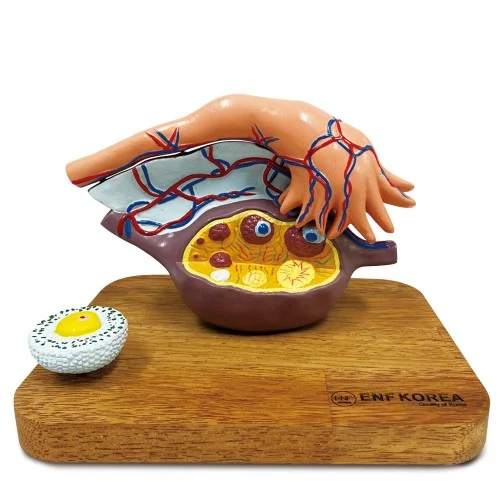 [EU72A] Enlarged Ovary Model